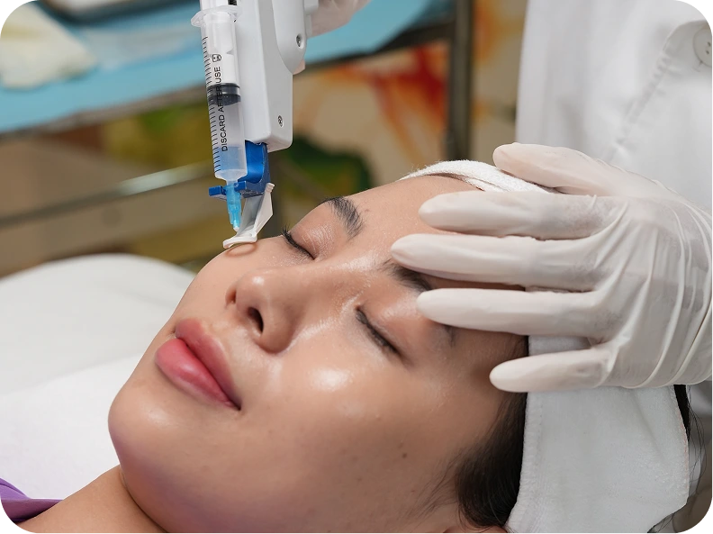 TIÊM MESO TRỊ NÁM