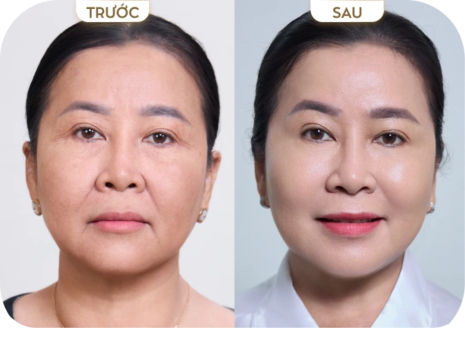 Trần Thị Vân [Bình Dương]