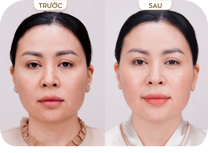 Lê Thị Hồng Ngọc [Bình Dương]