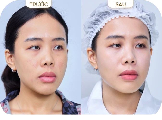 Lê Thị Minh [Bình Dương]