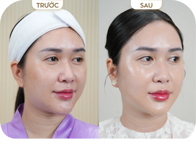 Phùng Kim Tuyến [TP.HCM]