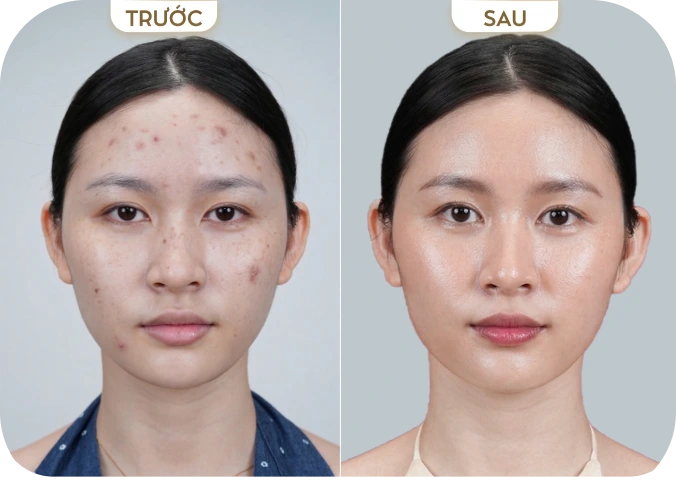 Nguyễn Trần Thảo My [TP.HCM]