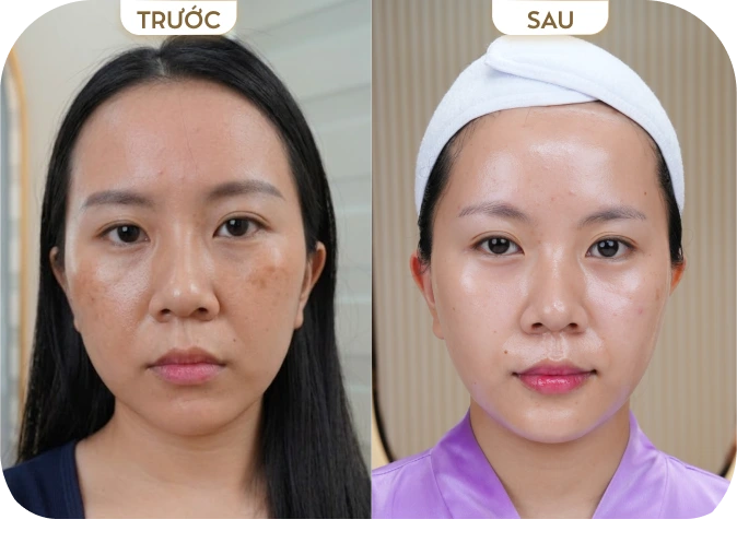 Phan Diệu Linh [TP.HCM]