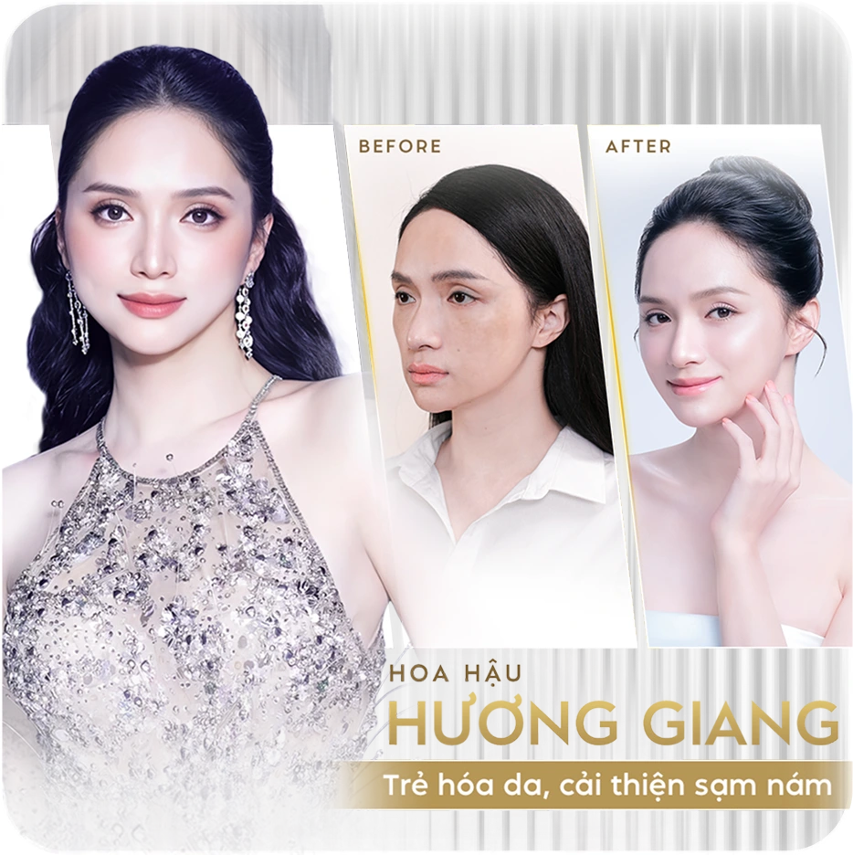 Sao Việt tin chọn Linh Anh 1