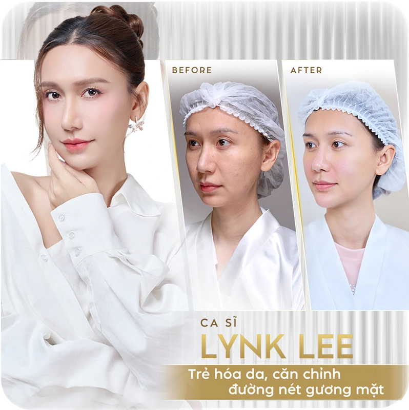 Sao Việt tin chọn Linh Anh 3