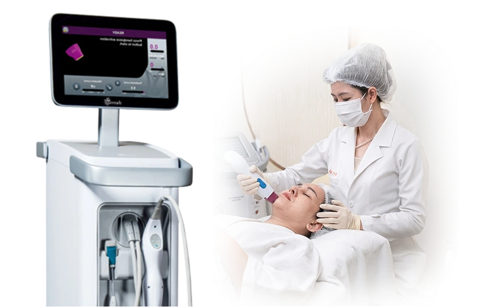 Công nghệ Thermage FLX