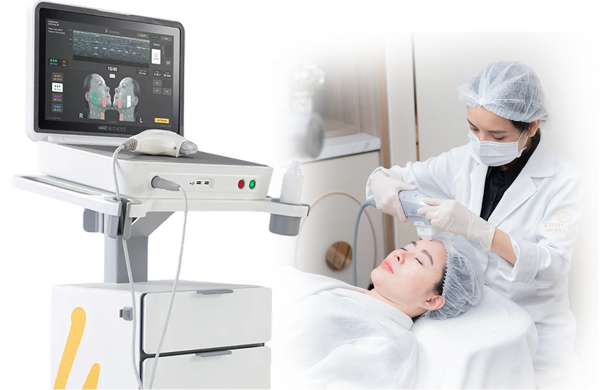 Công nghệ Ultherapy Prime