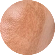 Chi tiết ĐIỀU TRỊ NÁM