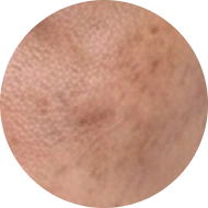 Chi tiết ĐIỀU TRỊ THÂM