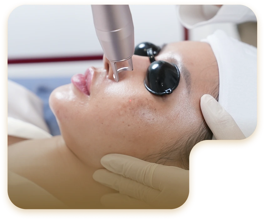 ĐIỀU TRỊ TÀN NHANG