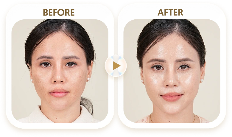 LÊ THẢO- 30 TUỔI