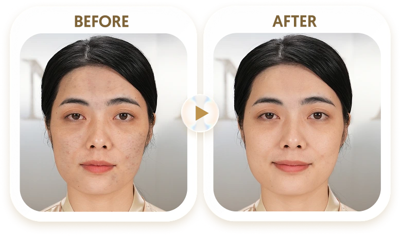 MINH LAI - 32 TUỔI