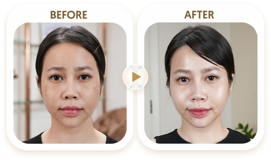 PHẠM TRÂN - 28 TUỔI