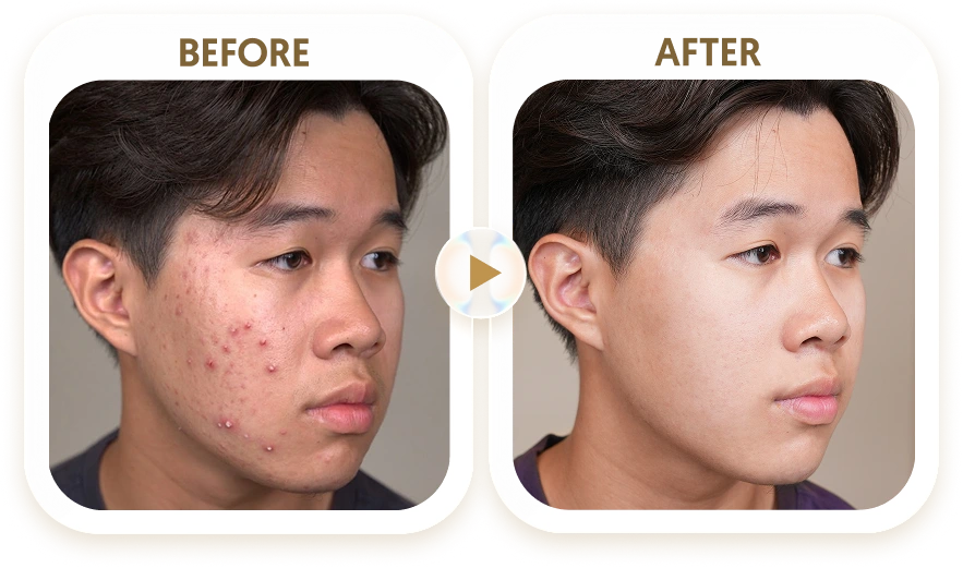 THANH HẢI - 24 TUỔI