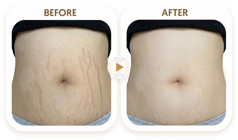 THỊ PHƯỢNG - 40 TUỔI