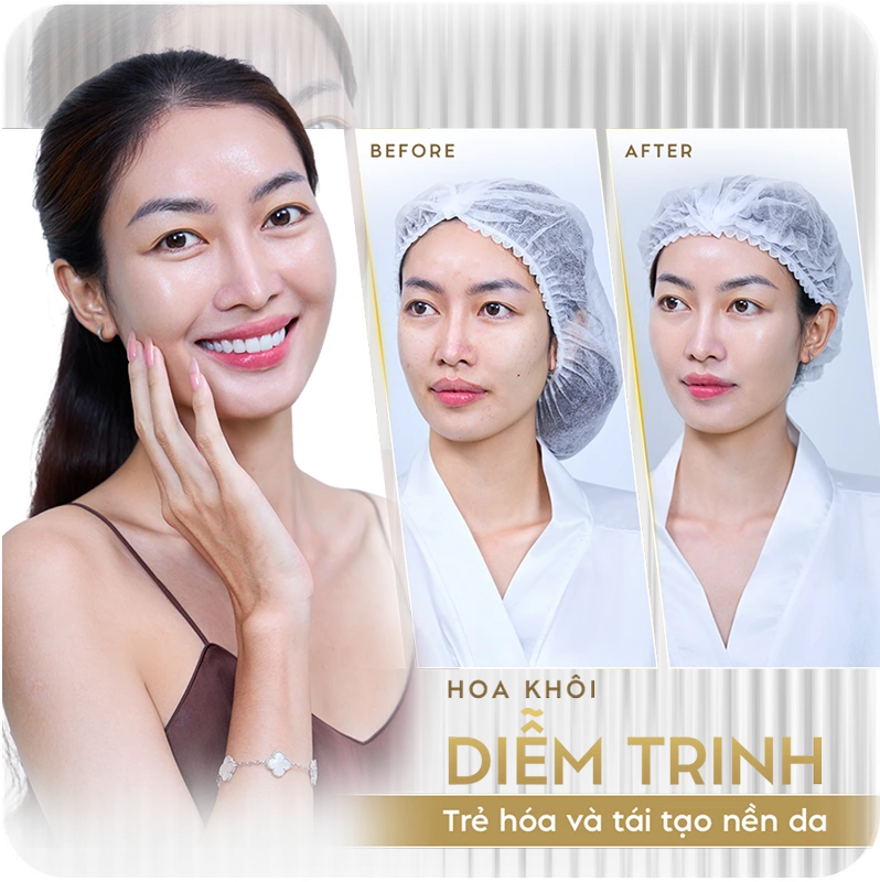 Sao Việt tin chọn Linh Anh 5