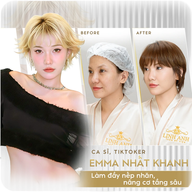 Sao Việt tin chọn Linh Anh 4