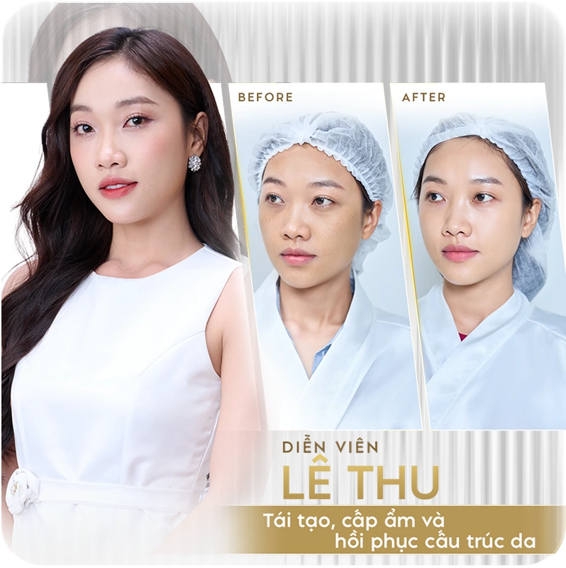 Sao Việt tin chọn Linh Anh 6