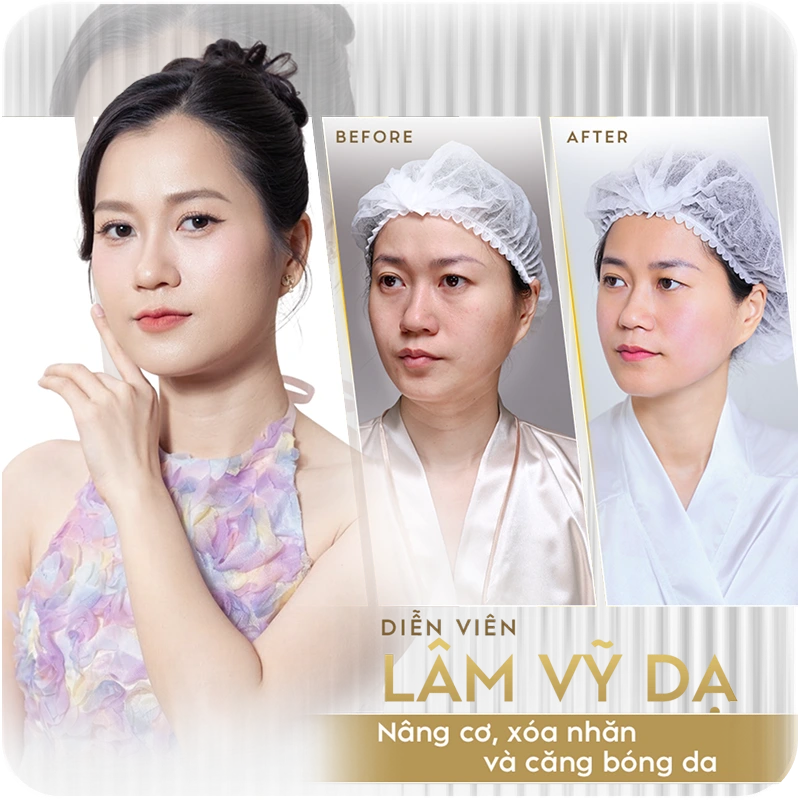 Sao Việt tin chọn Linh Anh 2