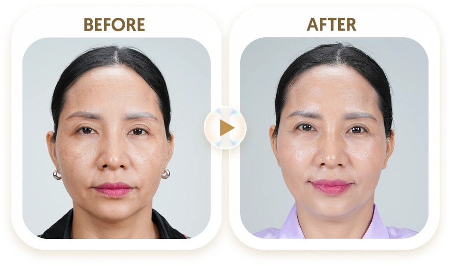 MINH HẠNH - 54 TUỔI