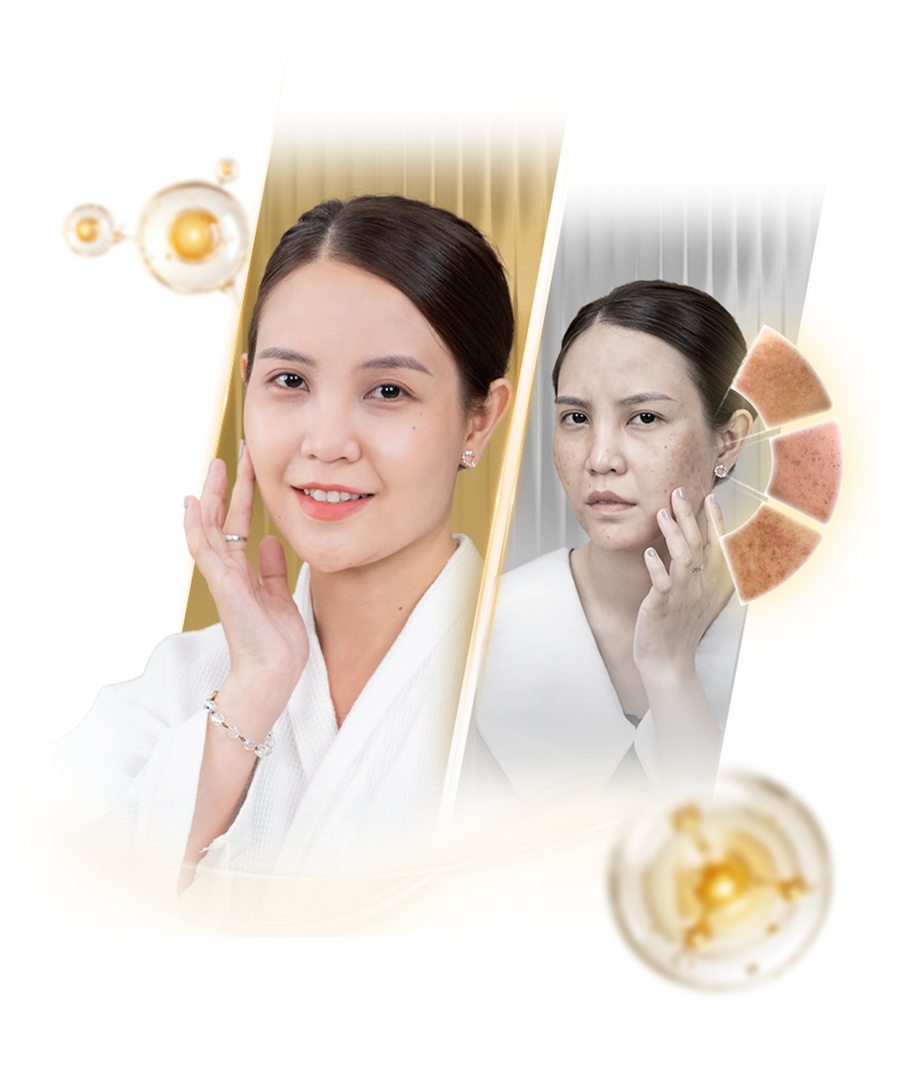 Kết quả trị nám tại Linh Anh Clinic