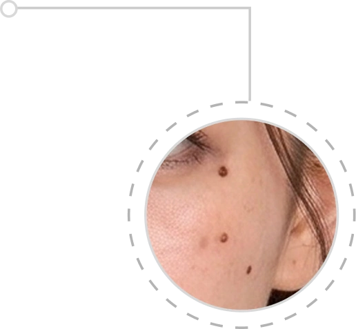 Nốt ruồi Desktop